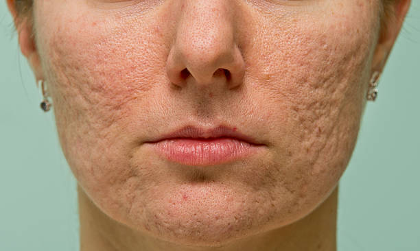 Close-up of a woman's face focusing on skin texture and pores