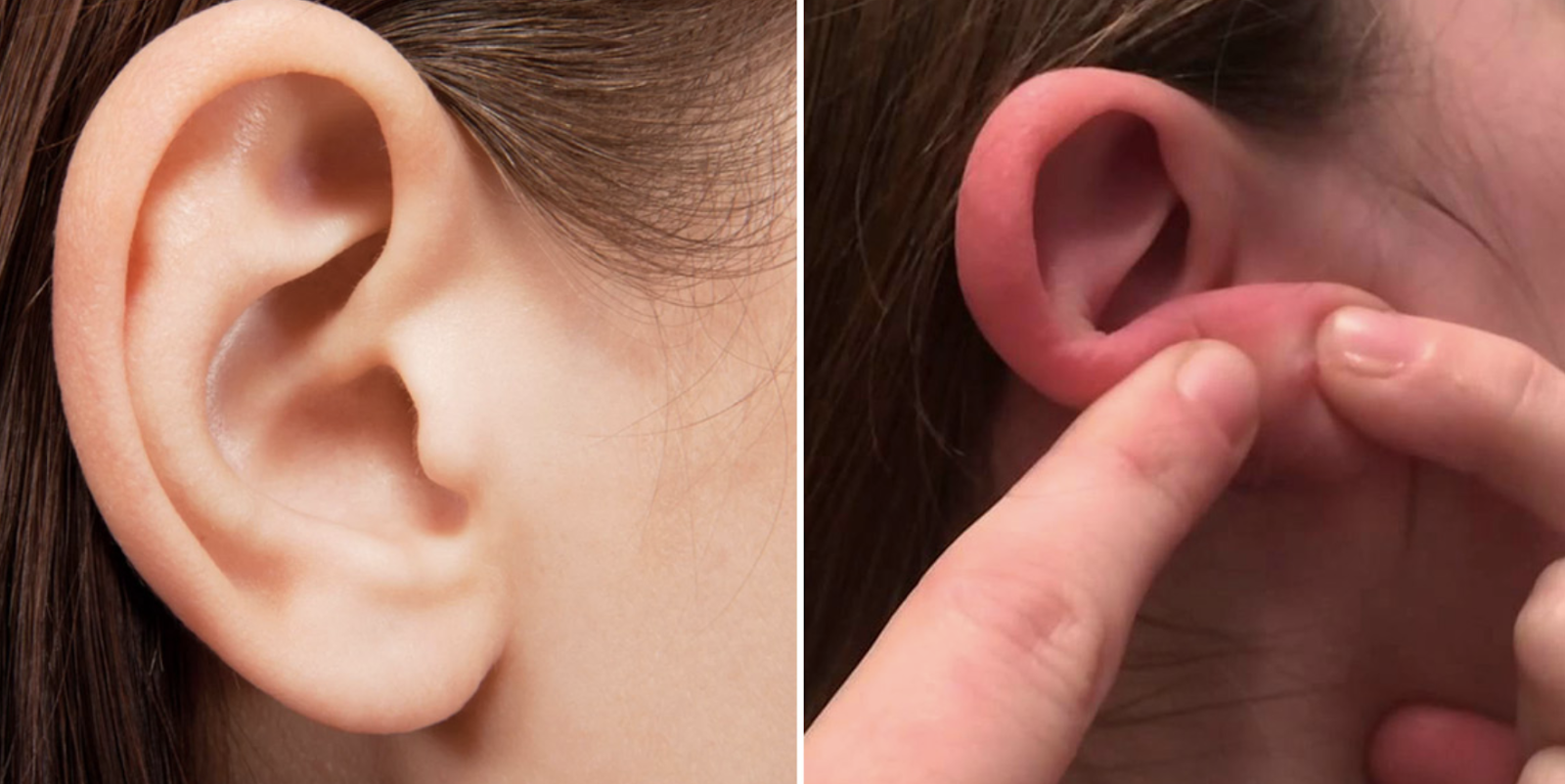 Close-up of blackhead extraction from inner ear using cotton swab