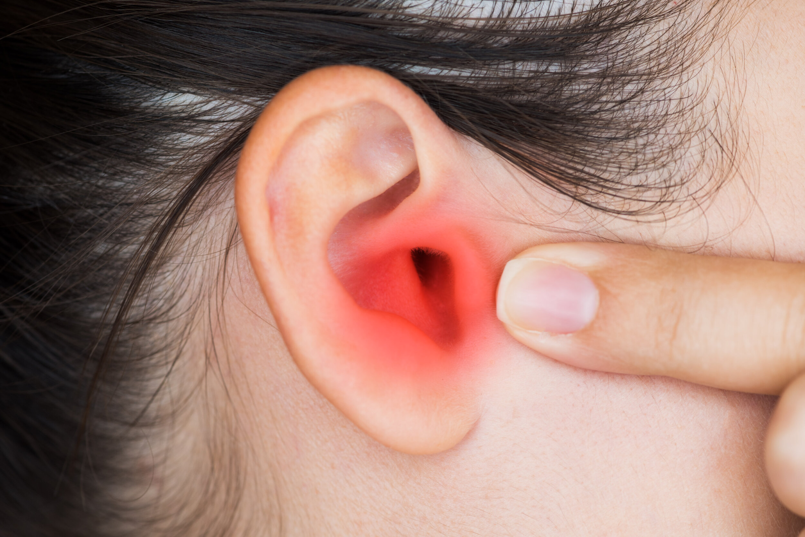 Woman applying topical treatment to eliminate blackheads in the ear